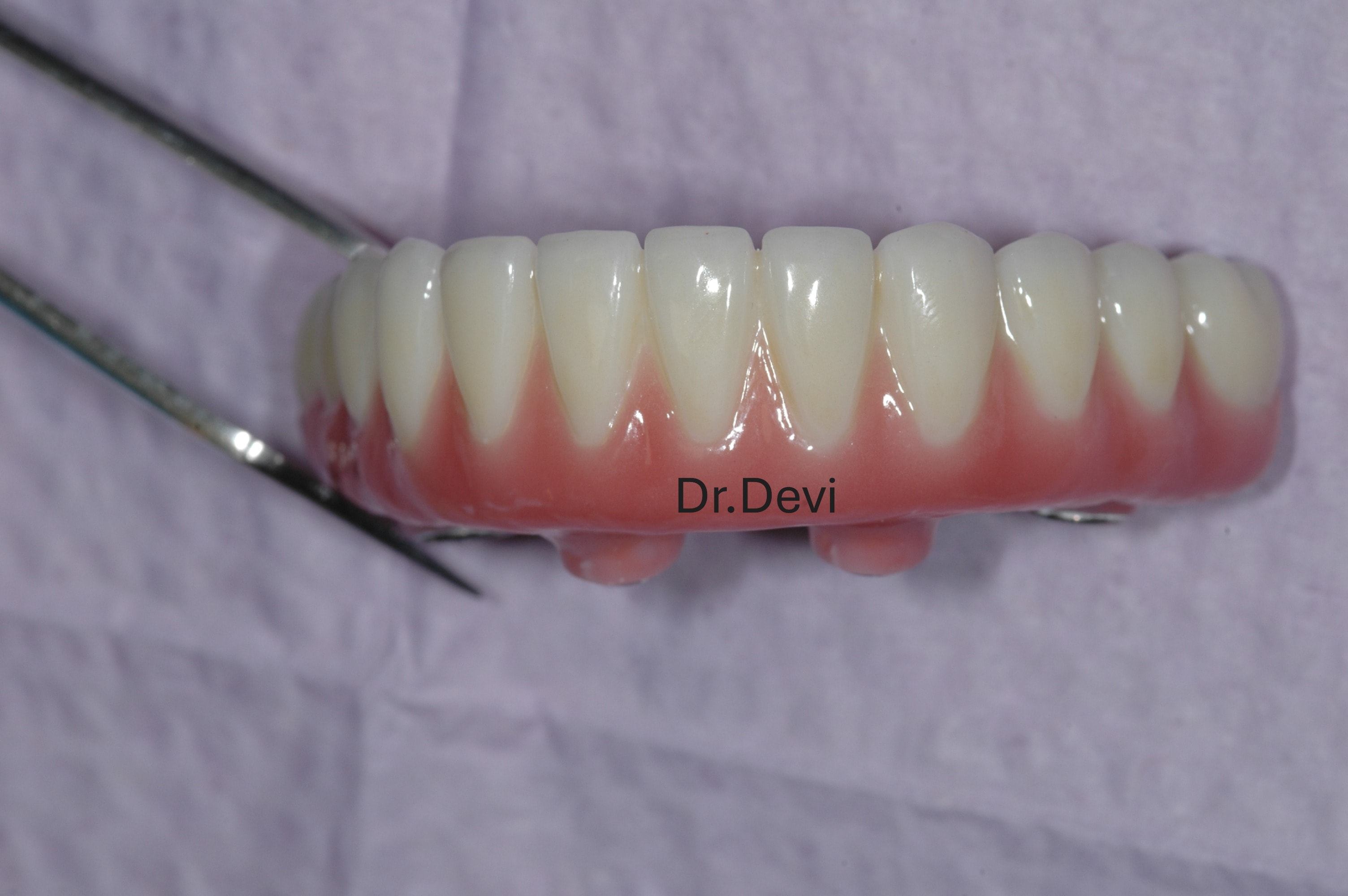 Dental implant surgery procedure
