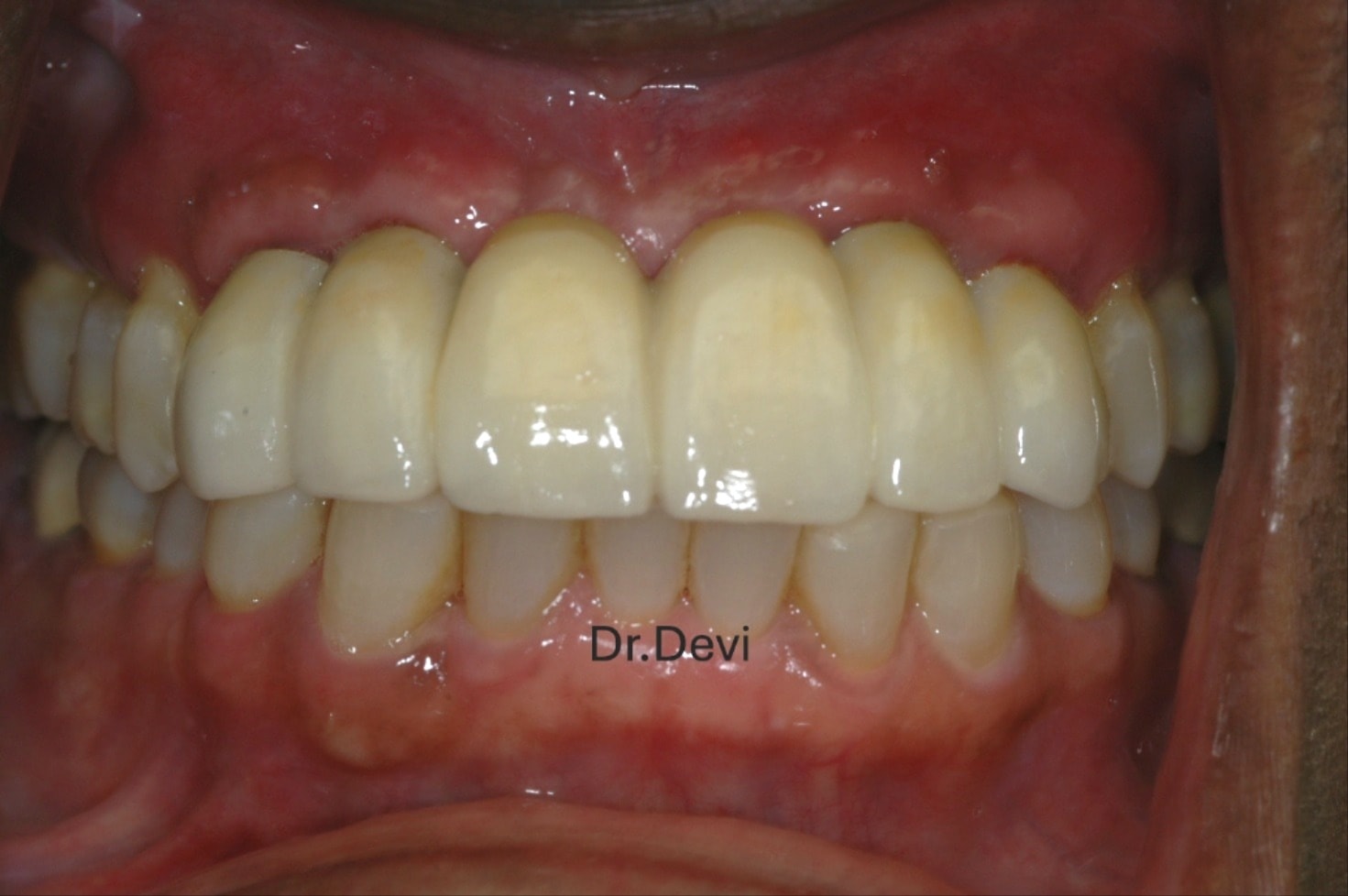 Dentist patient consultation